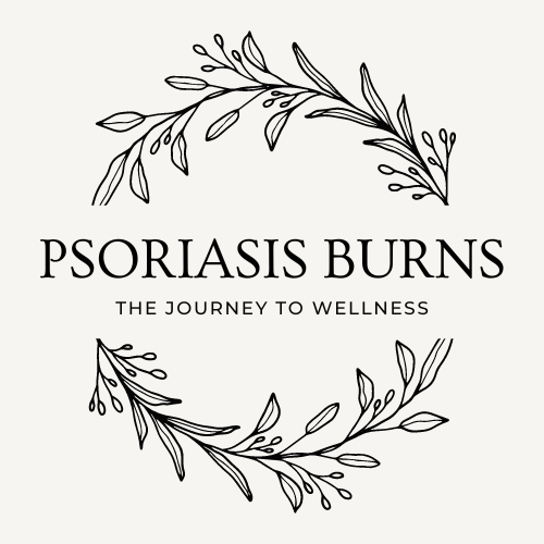 Psoriasis Burns